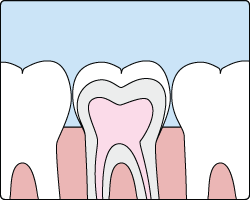 Sealants